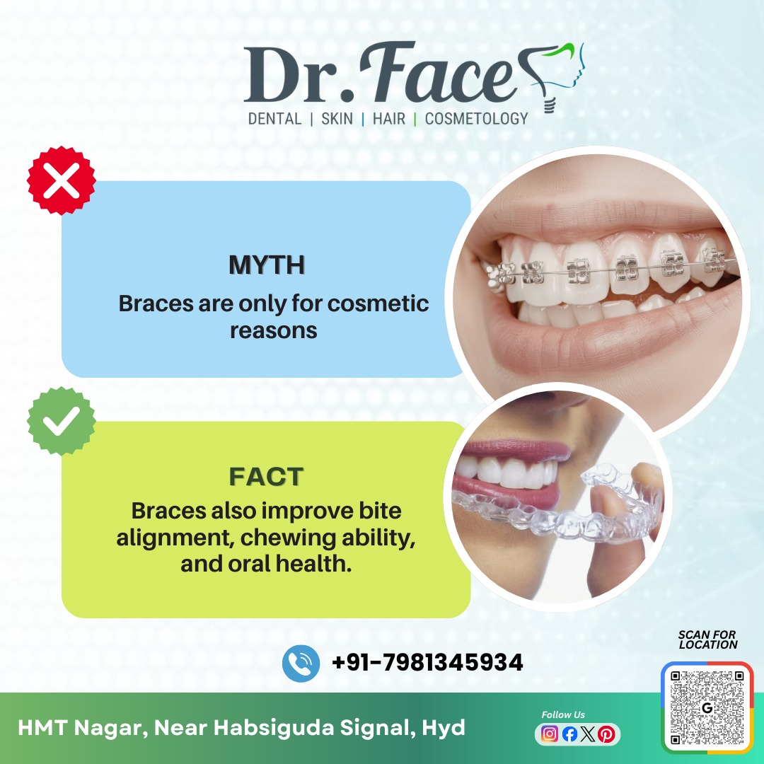Braces & aligners β straighter teeth, better bite and balanced profile
